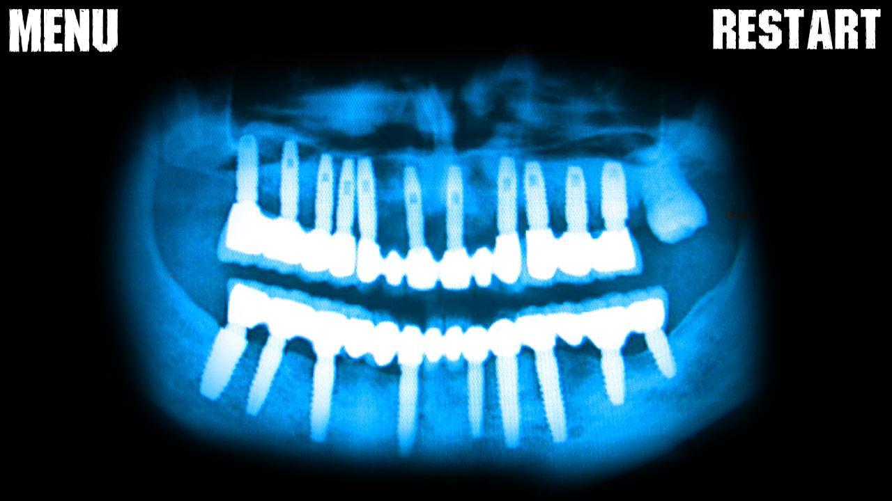 X-ray Teeth Joke