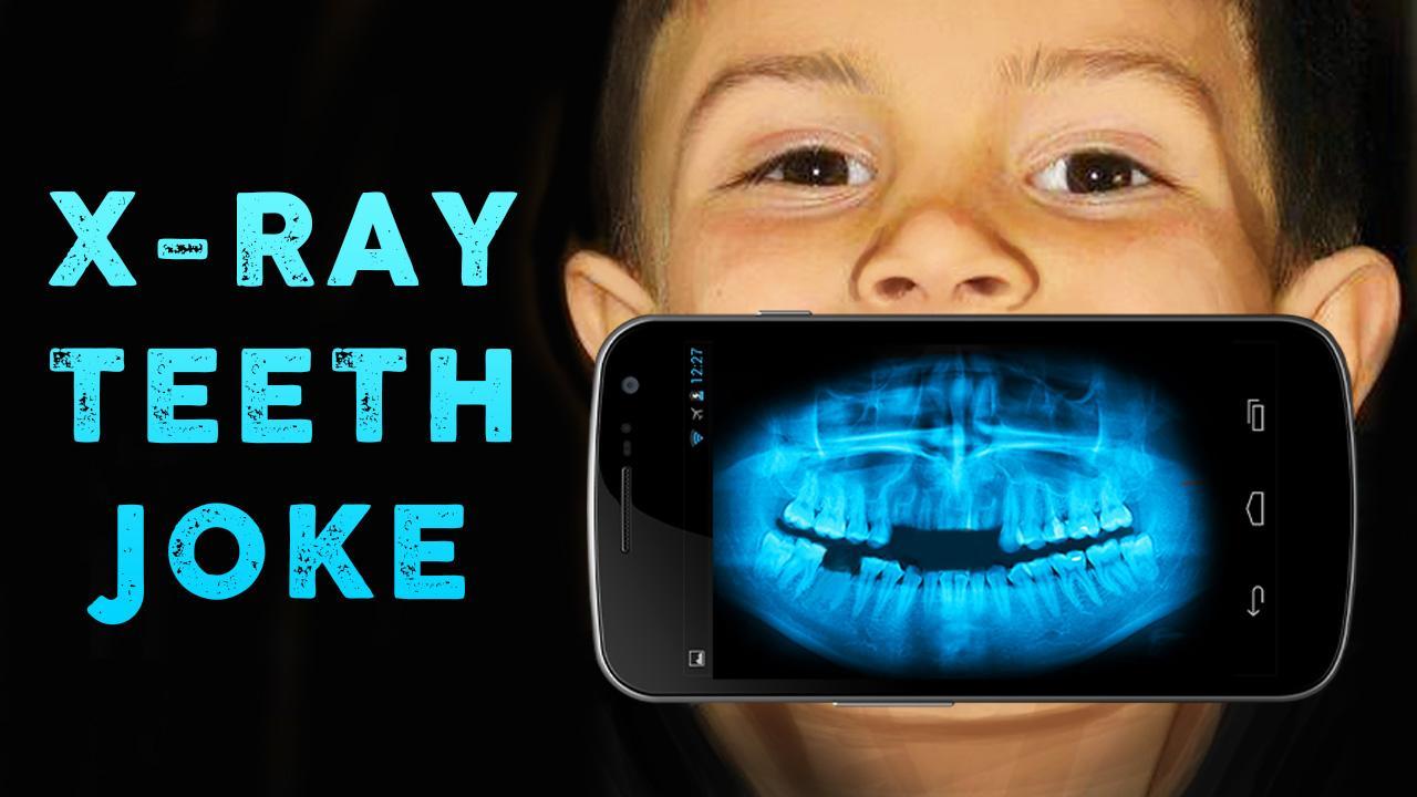 X-ray Teeth Joke