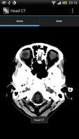 RadRevision: Anatomy on CT