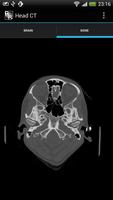 RadRevision: Anatomy on CT